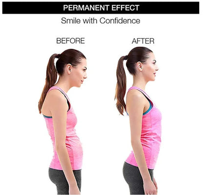 AstoFit Posture Corrector – Adjustable Back Support